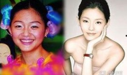 刘美丽爆料整容视频大全,揭秘明星美丽背后的秘密